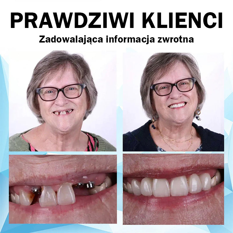 𝐁𝐢𝐤𝐞𝐧𝐝𝐚™ 🦷Zestaw do wyściełania protez silikonowych