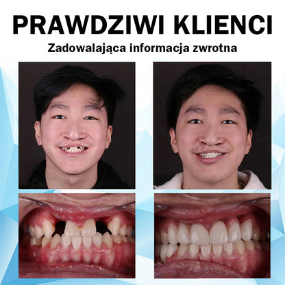 𝐁𝐢𝐤𝐞𝐧𝐝𝐚™ 🦷Zestaw do wyściełania protez silikonowych